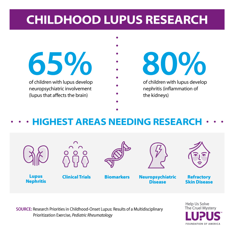 research paper on lupus
