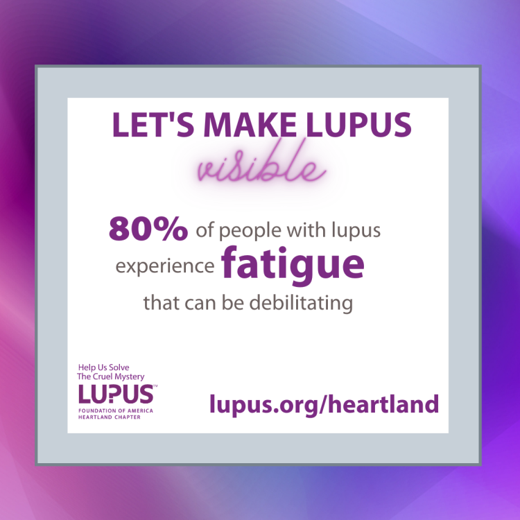 80% of people with lupus have fatigue