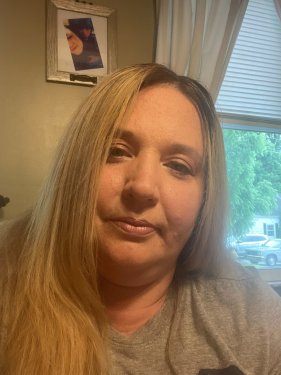 lupus story