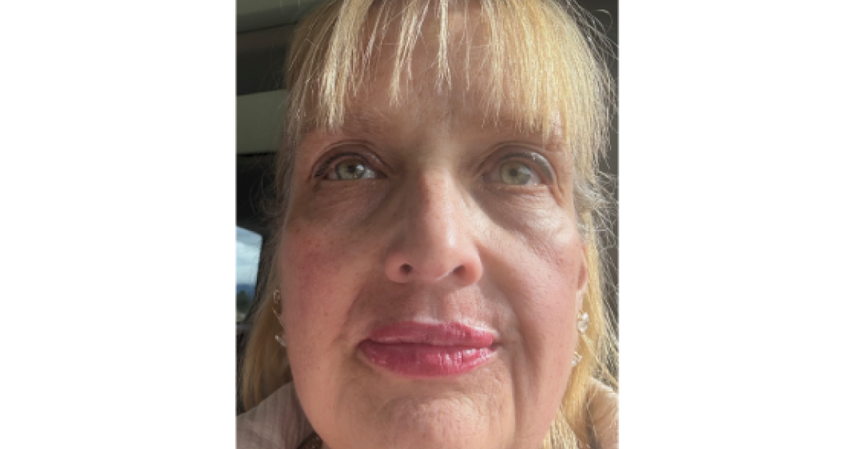 Kathleen R. - Diagnosed at age 38 | Lupus Foundation of America