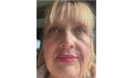 Kathleen R. - Diagnosed at age 38