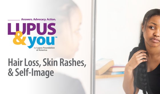 Event Resources from Lupus & You: Hair Loss, Skin Rashes, and Self-Image