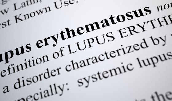 Lupus معنى